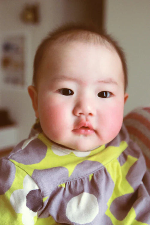 什麼是超敏感寶寶肌膚？ - Mustela Hong Kong - 1