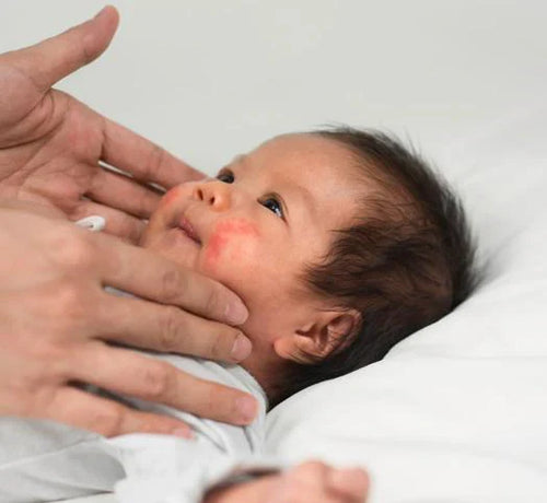 正確塗抹護膚品的建議 - Mustela Hong Kong - 1