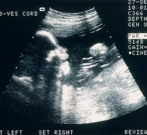 無菸孕期指引 - Mustela Hong Kong - 1